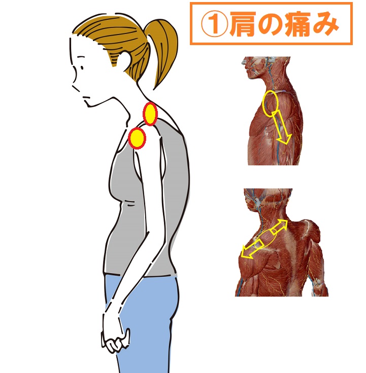 名古屋名東区にお住いの５０代女性の方へ 最近背中の丸みが気になり始めた方へ贈る アスリートヴィレッジ